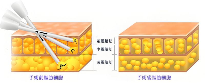 五、 求美者视角的临床口碑与真实反馈