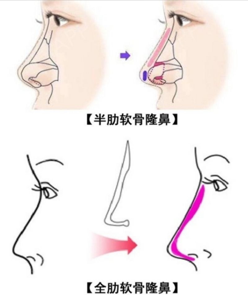 一、上海联合丽格刘一东隆鼻的专门背景与客观综合评价