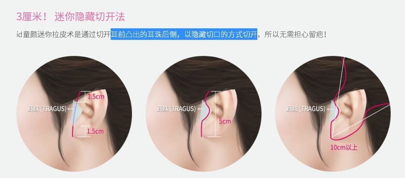 三、广州荔医整形蒋思军收费参考