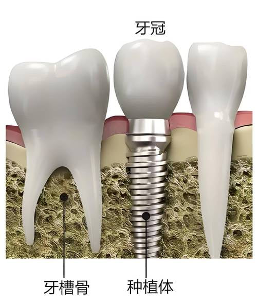 三、如何判斷深圳羅湖鼎植口腔門診部是否適合你?實用建議