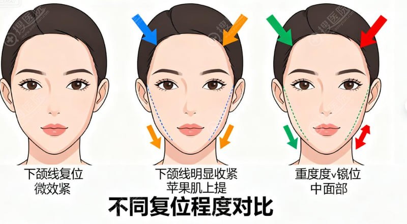 �����޲�ܭ����ԤԼ����������ܿ��Ŷӵ���Чֱ��·��
