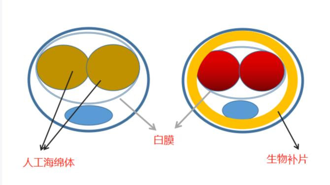 关于广州生殖整形医生王文卫的常见疑问解答