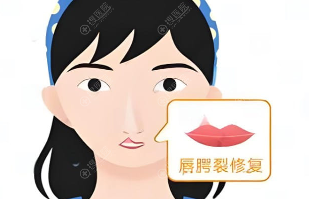广州高尚邹吉平唇裂修复患者核心痛点 广州高尚邹吉平唇裂修复患者核心痛点