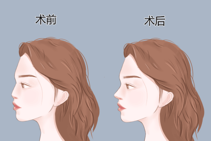 一、甄永环是谁?