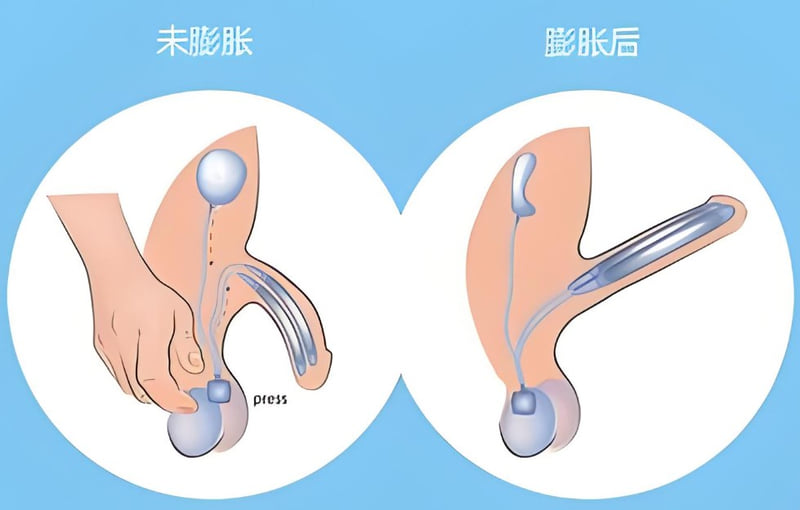 三、选择王文卫医生手术前必须了解的事项