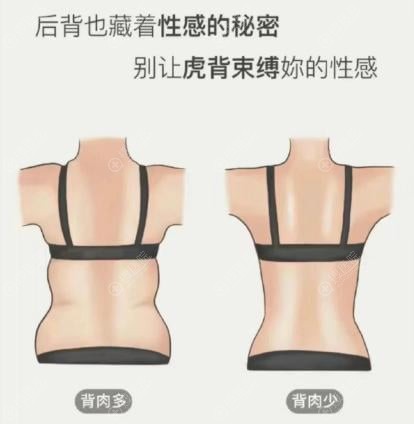 五、 告别拥挤与等待:有效预约成都恒博天姿李烈吸脂与信息对比分享