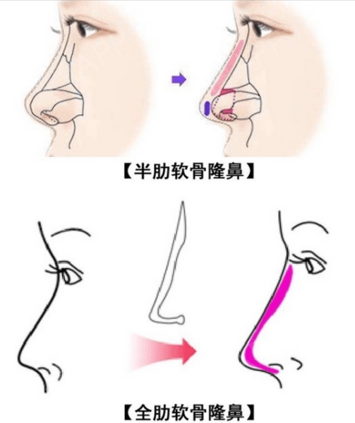 �塢��ʵ�û������뷴ֱ������