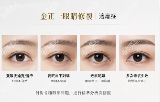 金正一院長能在韓國眼修復領域獨樹一幟 金正一院長能在韓國眼修復領域獨樹一幟