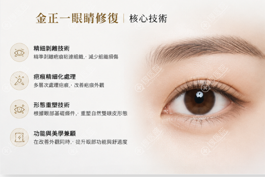 金正一眼部修復四大核心標誌性項目 金正一眼部修復四大核心標誌性項目