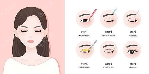 κ����˫��Ƥ�ĺ�����������
