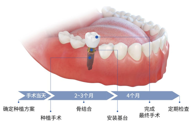 三、 武穴中山口腔医院核心诊疗项目与医生技术分析