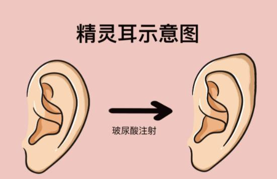 精灵耳-护理要点