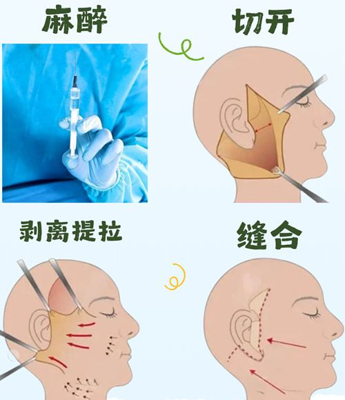 3. 行业位置:和谁并列