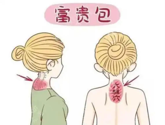 ���������ǲ��ǡ�����˰������������ԭ���Ͳ���ϸ��