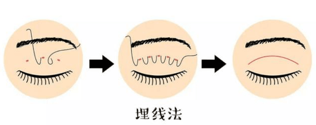 六、做过的人怎么说?