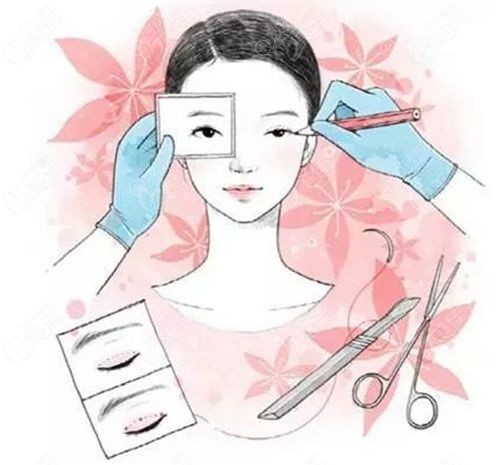 韓國在敦整形徐在敦雙眼皮技术特色 韓國在敦整形徐在敦雙眼皮技术特色