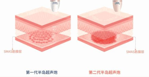 三、如何判断自己适合哪个项目?