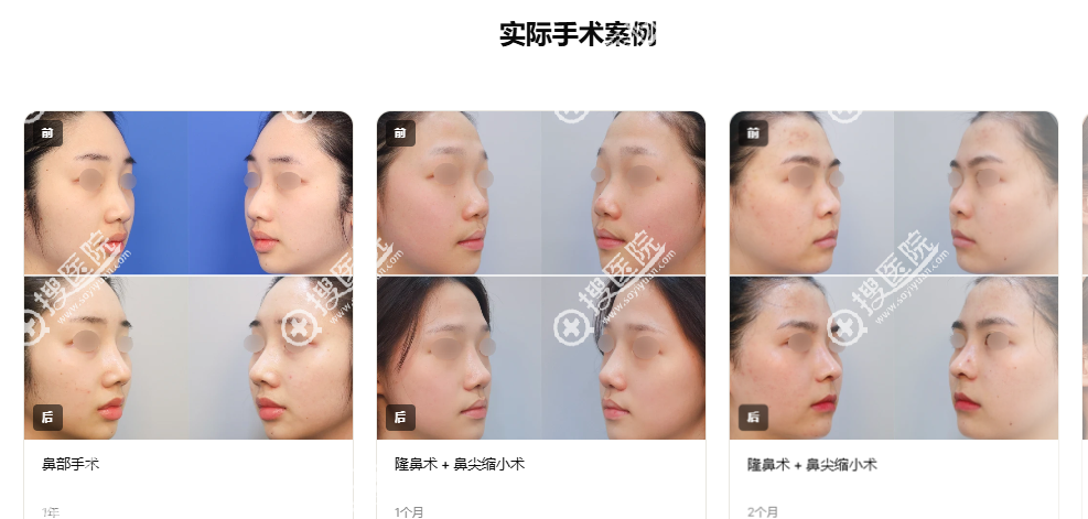 �n��LINK������Ƶĺ�����ɫ֮һ���ǾC��