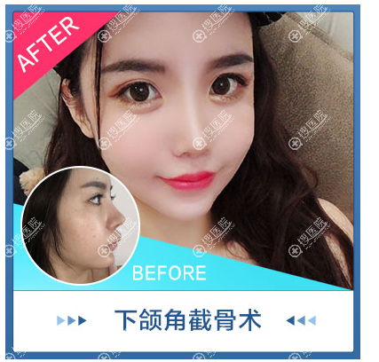 李相雨醫生专门方向 李相雨醫生专门方向