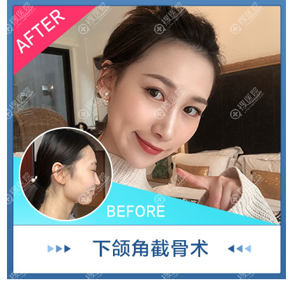 李相雨醫生的面部輪廓特色 李相雨醫生的面部輪廓特色