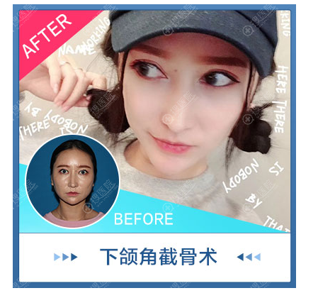 李相雨醫生实例 李相雨醫生实例