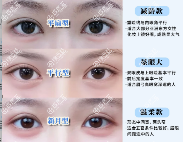 沙新力双眼皮有哪些风格? 沙新力双眼皮有哪些风格?