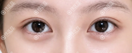 沙新力院长不在美莲了 沙新力院长不在美莲了