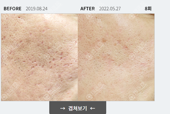 如何使用 BeautsGO APP 預約釜山露潭韓醫院? 如何使用 BeautsGO APP 預約釜山露潭韓醫院?