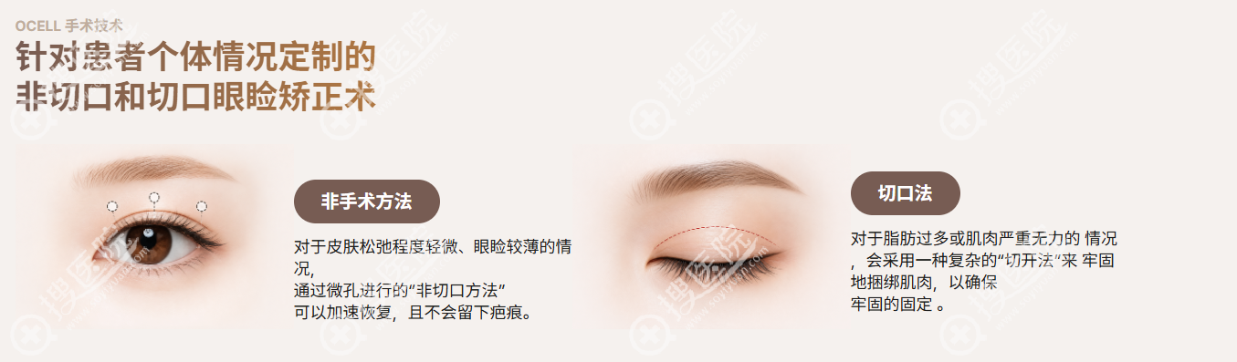 韓國OCELL整形中心有哪些手術 韓國OCELL整形中心有哪些手術