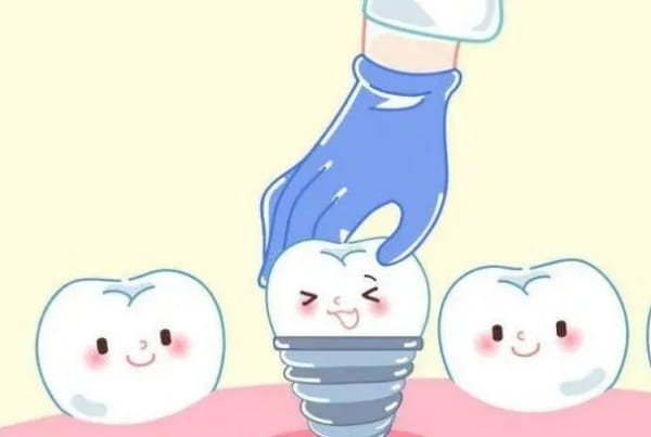 成都极光口腔医院儿童矫正和种植牙的价格透明吗